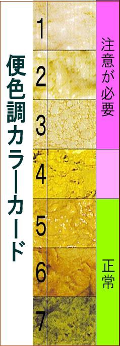 胆道閉鎖症の早期発見へ カラーカードを母子手帳に 山本節