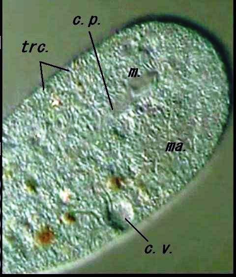 Monochilum Frontatum Or Elongatum 動画付き 滴虫界 Infusorian World Ciliates Amoebae Flagellates ｅｔｃ