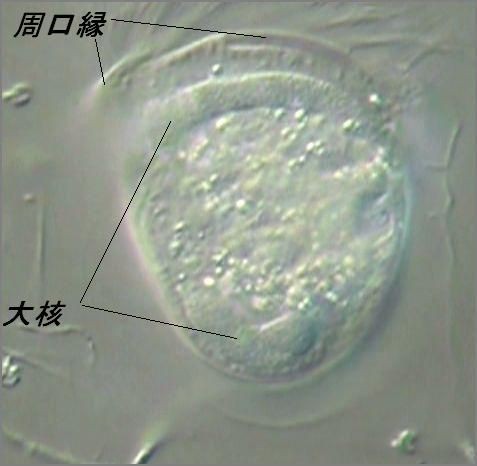 Vorticella Campanulla ツリガネムシの一種 滴虫界 Infusorian World Ciliates Amoebae Flagellates ｅｔｃ