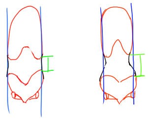 骨盤の性差とウエストの見え方 イラストのはなしをしよう