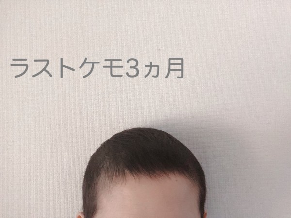 ラストケモ3ヶ月の発毛状況 Jamのおうち ごはんと器とインテリア Powered By ライブドアブログ