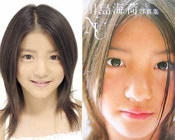 画像あり 川島海荷が激太りだって 美容外科医ジョニー