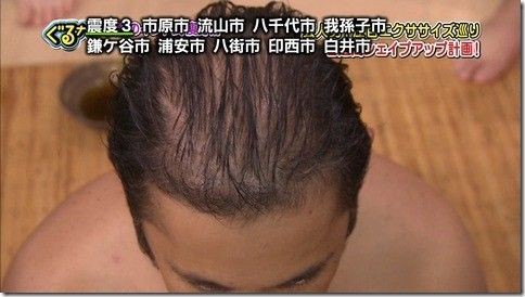 ナイナイの岡村隆史さん 髪が復活してきた ミノキシジルとプロペシアで育毛 育毛ニュース