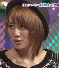 今年卒業のakbたかみなの顎ニキビがひどい スピーチよりもニキビに注目 カラダの悩み解決マガジンカラダライフ編集部日記 ココロライフ