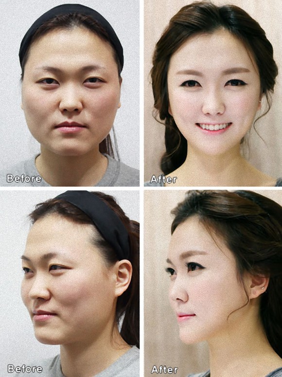 韓国の美容整形病院が外国人に向けて発行する「整形証明書」 : カラパイア