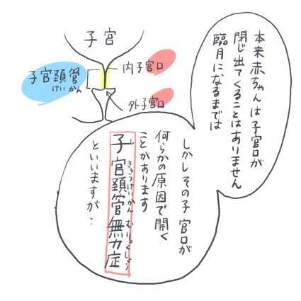 2人目妊娠記録15 子宮頚管無力症の手術 あしたのふたり 低体重児姉妹育児日記 Powered By ライブドアブログ