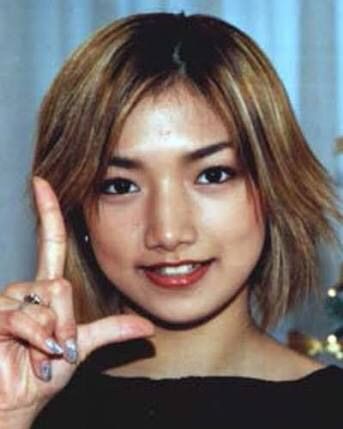 整形 画像 河北麻友子もおでこプレートだった 健康まとめ