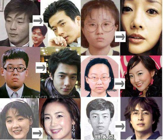 整形した韓国芸能人 歌手や俳優 は誰 こぐまの韓国news
