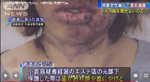 暴行 千葉県女性 26 同居女性にボコボコされ全治4か月 熱湯 竹串 ペンチで刃折り 拷問だろこれ ニュー速2ch