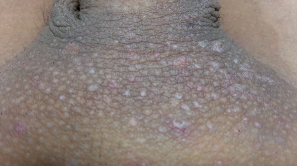 ちん毛 四年間毎日抜きまくった結果ｗｗｗｗｗｗｗｗｗｗｗｗｗｗｗｗｗｗｗｗｗｗｗｗｗｗｗｗｗ くるくるｖｉｐ