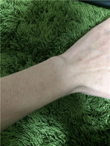 手首を太くする方法教えて欲しいんだが Dqnニュース ﾉ