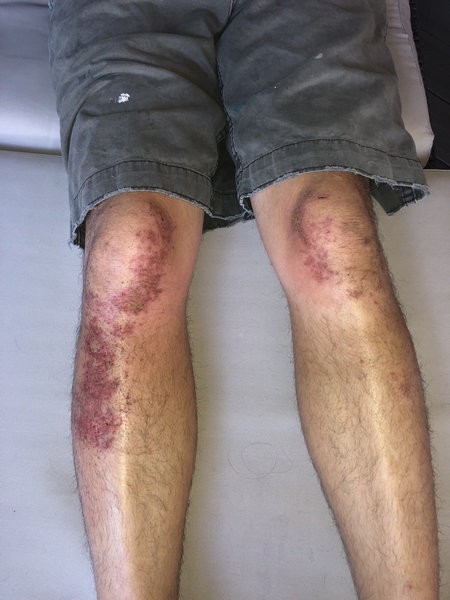 サイクリストの男性 うっかり塗り立てのセメントに突っ込むと こうなるよ 説得力のある姿 らばq