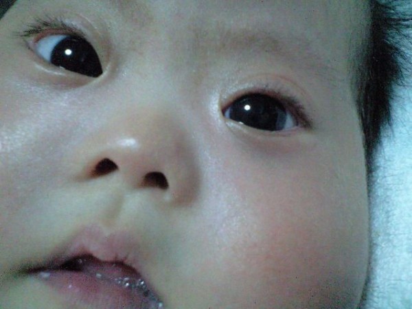 ほっぺカサカサ 頑張れ えなっち うちの子 ダウンちゃん