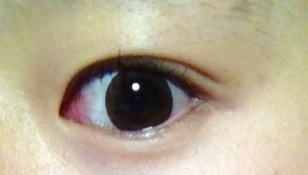 花粉 埋没経過 8 ブログ