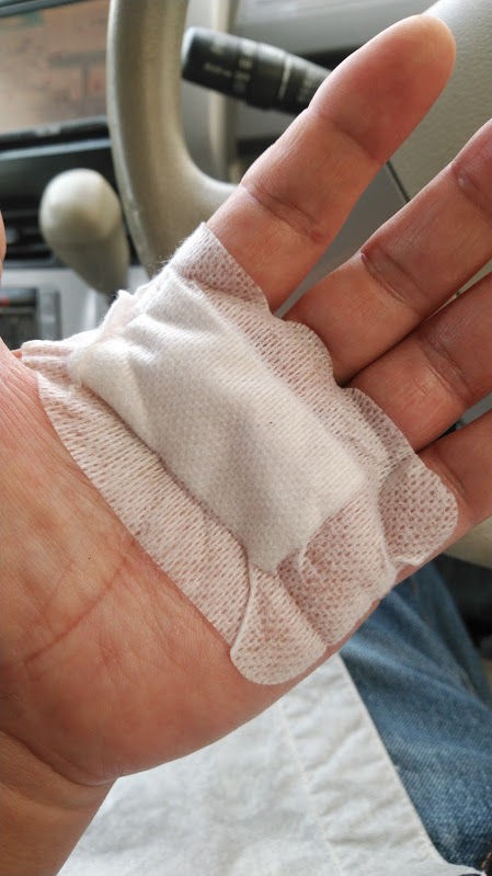 備忘録 ばね指手術と経過 その1 店長の休日