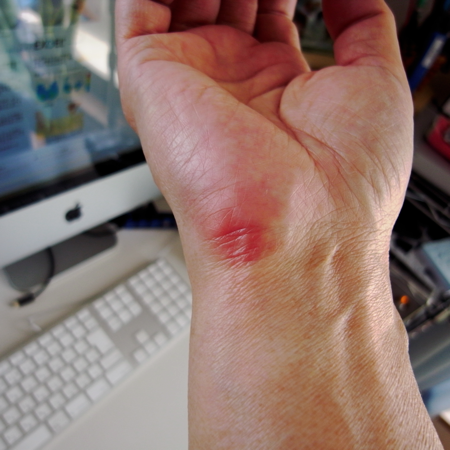 トラックボールでマウス症候群対策 Macintop トラックボールでマウス症候群対策 Macintop