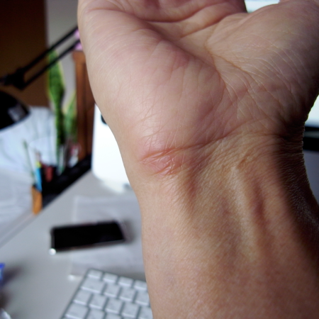 トラックボールでマウス症候群対策 Macintop トラックボールでマウス症候群対策 Macintop