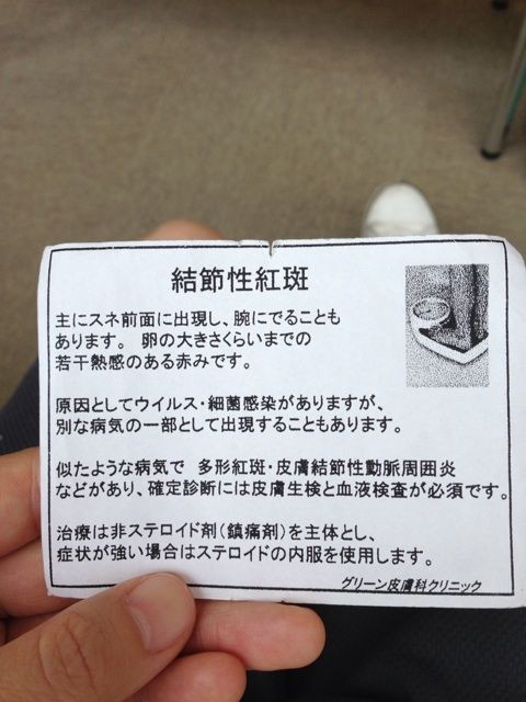 結節性紅斑 まこつ ふぁいあ
