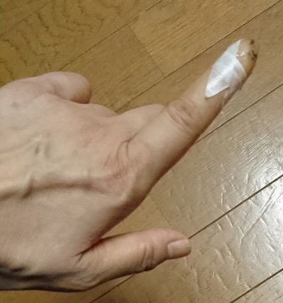 指切断に骨折疑い おてんば娘まる子ちゃんと仲間たち