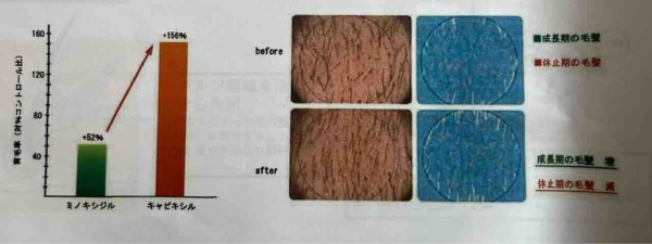 イチノ　スカルプシナジーエッセンス イチノ スカルプシナジーエッセンス : Natura+3Lab、落合のブログ