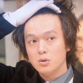 悲報 ジャニーズ事務所 頭皮が ボロボロな件 画像あり Mashlife通信