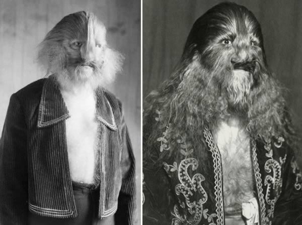 閲覧注意 奇病 ゴム人間 四本足の少女 生きたミイラ 見世物小屋で晒されていた人々をご覧ください Kwskニュース