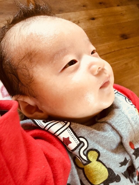 生後２カ月 首のただれ ７日目 プロペト軟膏 Meguのまいにち記録 ４児ままの育児日記