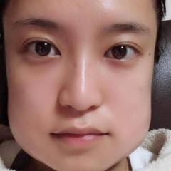 小島瑠璃子 抜歯直後の顔面変形にネット騒然 食パンマンみたい ゲンゲンのゆる い毎日
