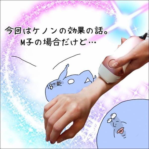 夏までまだ時間がある！家庭用脱毛器《ケノン》ゲットしちゃい  