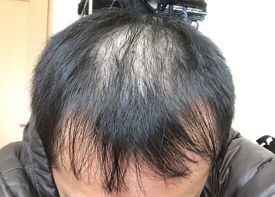 画像 湯シャンを1年続けた結果www まとめも