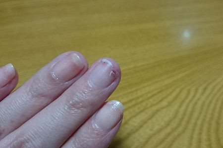 爪 その後 ミニかぞくの生態