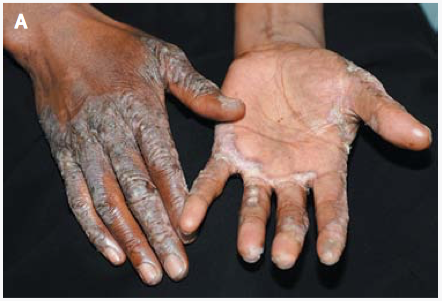 【裁断済み】 誤診されている皮膚疾患 Visual Dermatology『Visual