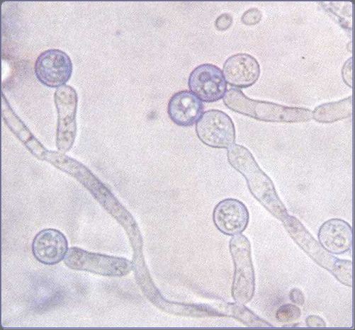 抗真菌薬抗寄生虫薬 太田東こども おとな診療所使用薬品解説