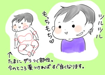 アトピー プロアクティブ療法の経過 なーみん絵日記 Powered By ライブドアブログ