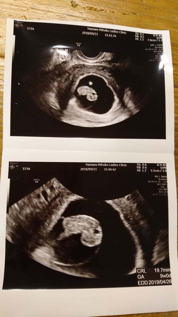 妊娠９週の壁 事実婚生活