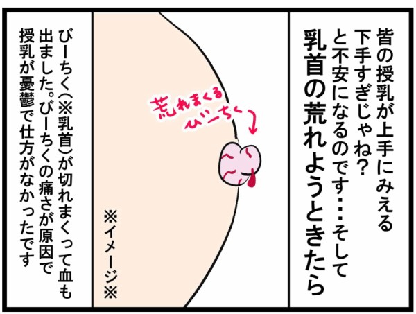 ほとんどのダウンロード 母乳 乳首 切れる 最優秀作品賞