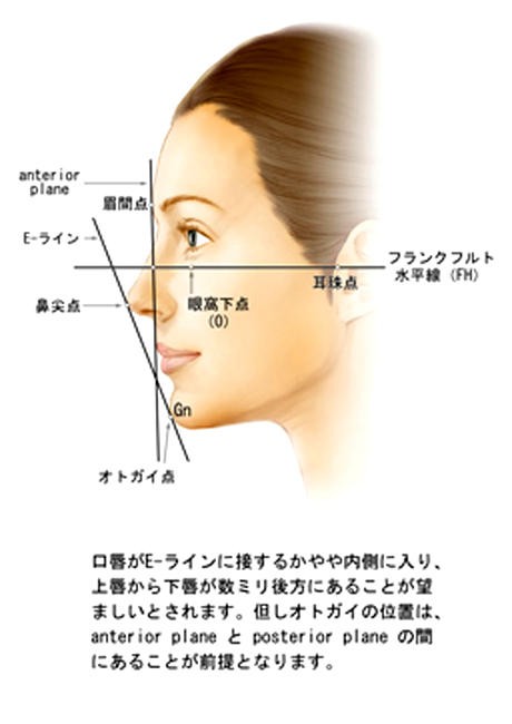 Eラインって言うほど重要なんかな Vipperな俺