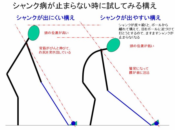 検体 笑 回る ゴルフ アイアン シャンク 原因 成熟した 縞模様の 厳密に