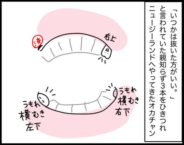 1週間で親知らず3本抜いた話 Nzにこにこ落書き