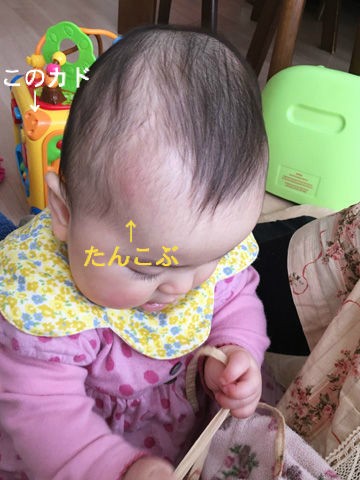 生後230日目 初たんこぶ 私の直感的育児