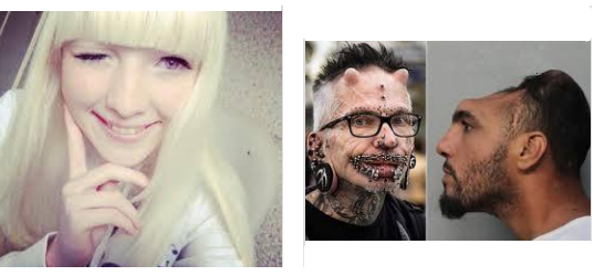 掲示板 奇病 奇形の画像を淡々と貼るスレ 閲覧注意 ニチャオプ報道 Nicha Op Coverage