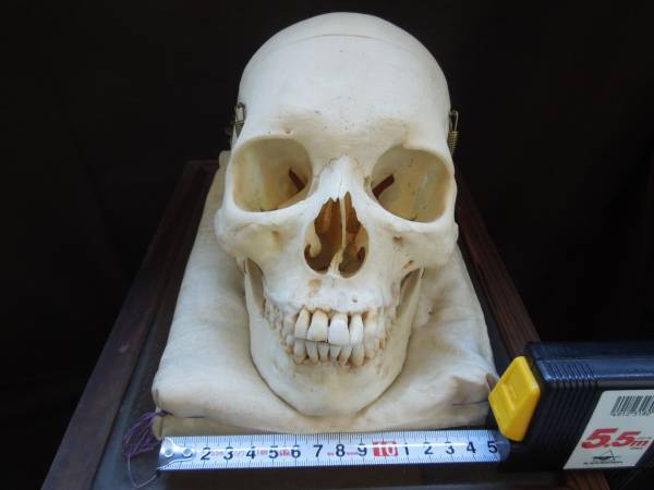 本物人骨 頭骸骨標本 歯科医療法人所有 経年品 A62 おかしな出品 ヤフオク探検隊