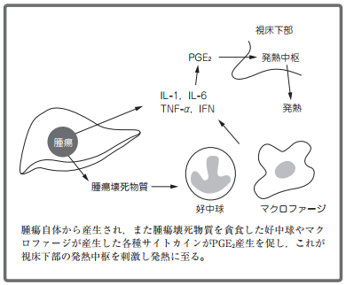 ナイキサンテストって 腫瘍熱とナイキサン 薬剤師メモ