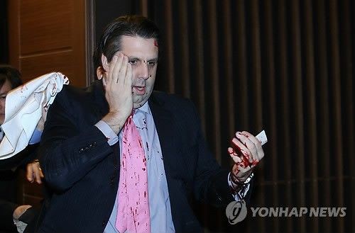 韓国の反応 駐韓米国大使リッパード 韓国人に襲撃されて顔などに大怪我 韓国の反応 みずきの女子知韓宣言