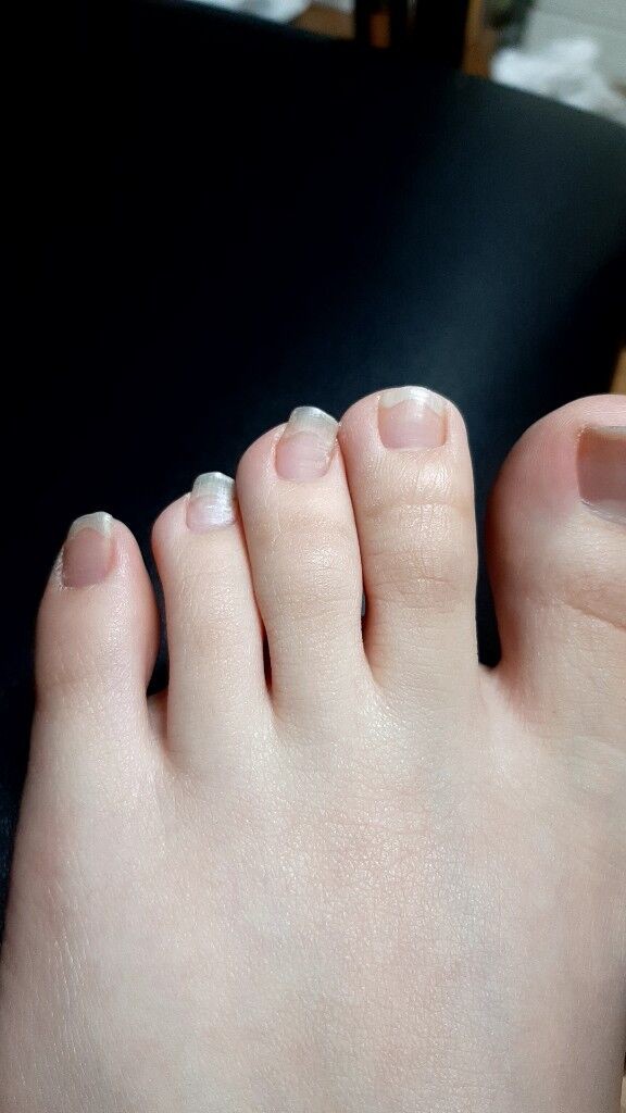 悲報 足の爪がなぜか斜めに生えてたんだけど ワイは見た速報