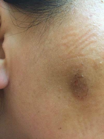 カソーダでシミ取り その A 岡製麺所 うどん屋日記