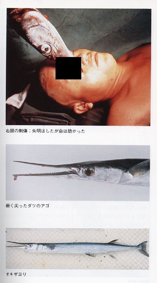 閲覧注意 釣り人少年の首に極太の ダツ が突き刺さってしまう お魚まとめ