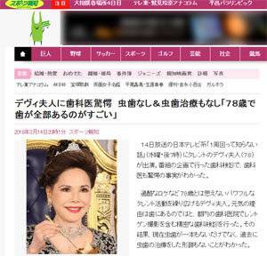 芸能 デヴィ夫人に歯科医驚愕 虫歯なし 虫歯治療もなし ７８歳で歯