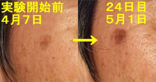 美と健康 カソーダで２回目の皮が剥けました 京丹後のおやじのうんちく日記 19世紀の味の店