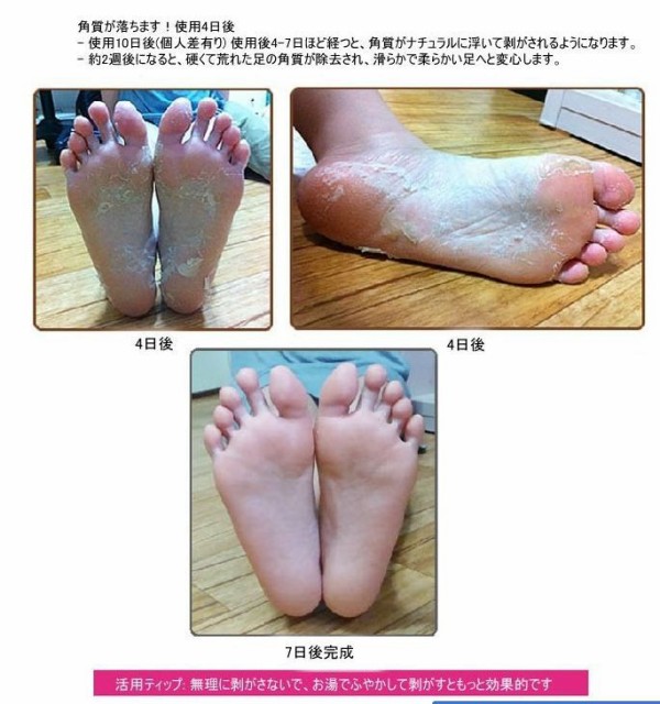 この足の裏 どうですか 人気韓国コスメの紹介